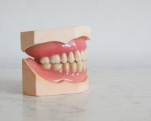 Pasang gigi palsu di dokter gigi Semarang